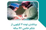 برداشتن توده ۴ کیلویی از شکم بیمار ۴۲ ساله