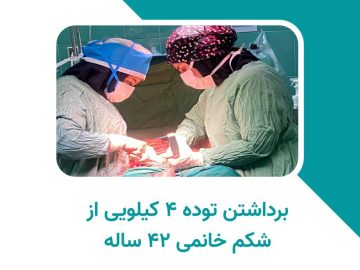 برداشتن توده ۴ کیلویی از شکم بیمار ۴۲ ساله